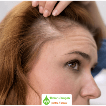 Te confrunți cu un scalp sensibil? Iată ce trebuie să știi